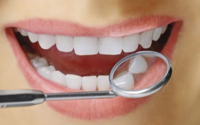 Методы реставрационного осветления зубов