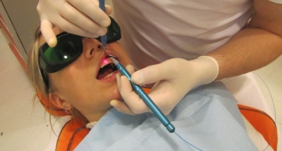 Лечение лазером зубов и тканей