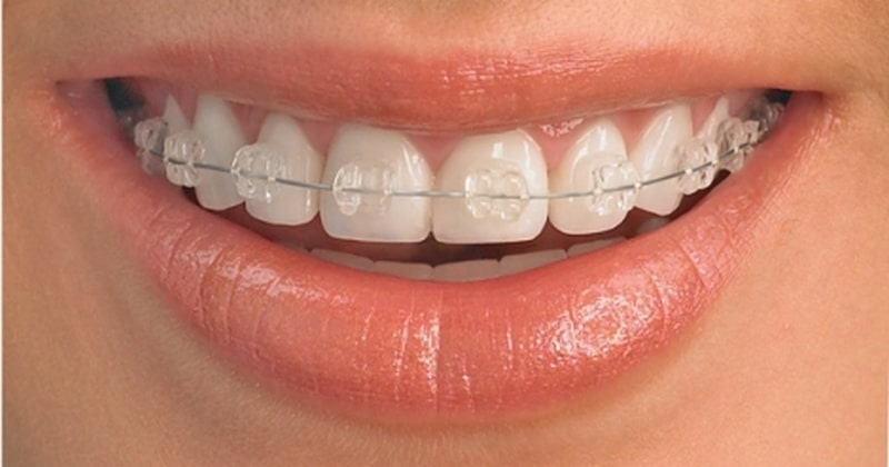 Эстетическая стоматология – что это такое
