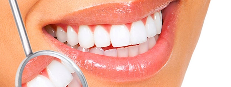 Что такое профессиональная чистка зубов