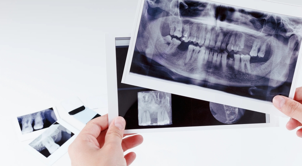 ортопантомограмма зубов