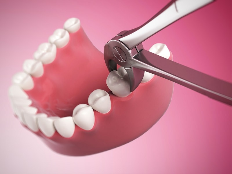 Подготовка к стоматологической операции