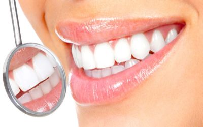 Отбеливание зубов стоматологами в Железнодорожном и Балашихе