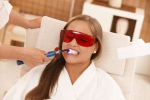 Способы отбеливания зубов
