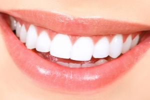 Безболезненно, быстро, эффективно – кислородное отбеливание зубов